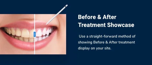 SmilePure - Dental & Medical Care WordPress Theme 5